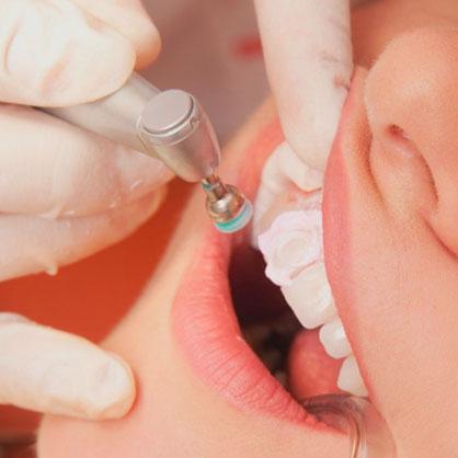 periodoncista-clinica-dental-manresa