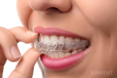 ortodoncia-invisible-invisalign-clinica-dental-manresa-junyent