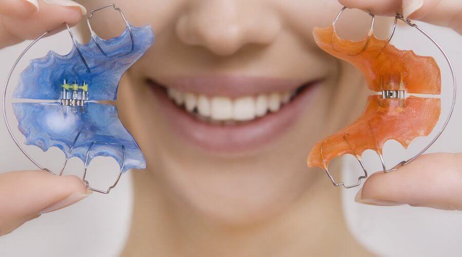 tipos-de-retenedores-ortodoncia