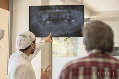 implante-dental-rechazado-junyent-manresa