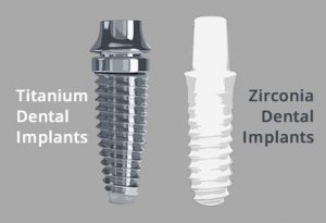 implantes-dentales-titanio-zirconio