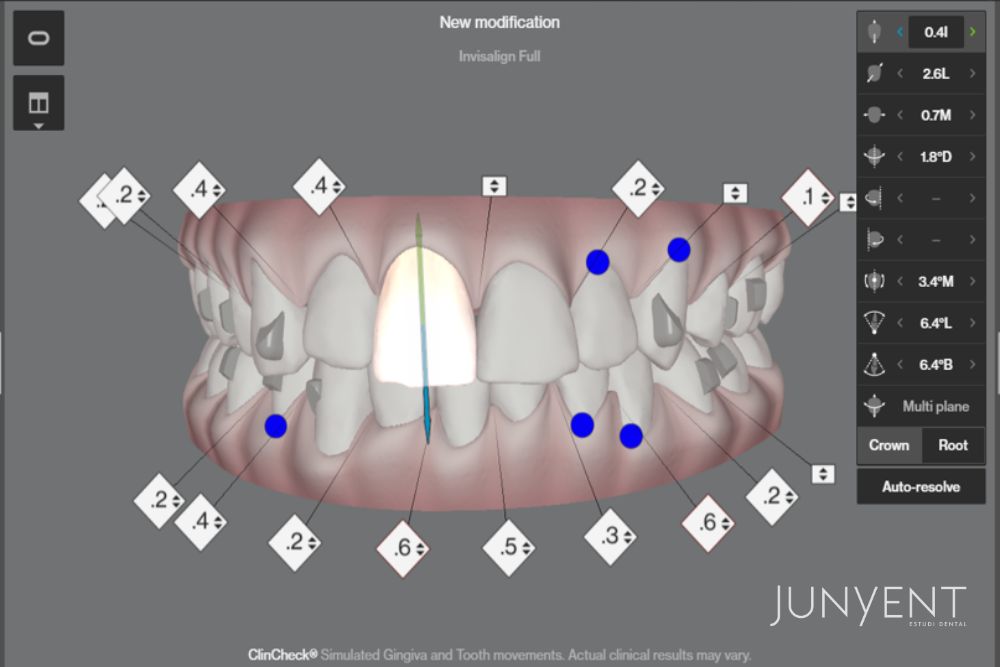 clincheck-invisalign-manresa