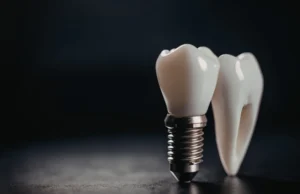 Imatge de tractament d'implants dentals per a arcades completes, amb un enfocament professional per a una rehabilitació oral total.